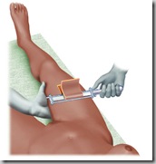knipper-fig09